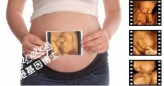 怀孕七周验血鉴定胎儿性别准不准? 