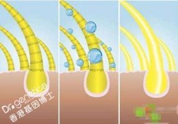 用头发做样本可以做DNA亲子鉴定吗 